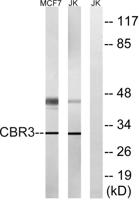 Carbonyl Reductase 3 Polyclonal Antibody