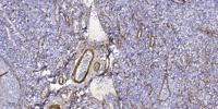 CARD 10 Polyclonal Antibody