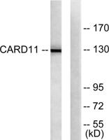 CARD 11 Polyclonal Antibody