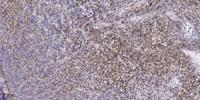 CARD 11 Polyclonal Antibody