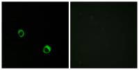 CARD 14 Polyclonal Antibody