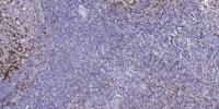 CARD 14 Polyclonal Antibody