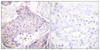 CARD 6 Polyclonal Antibody