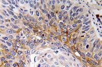 Cardiotrophin-1 Polyclonal Antibody