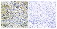 CARKL Polyclonal Antibody