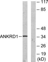 CARP Polyclonal Antibody