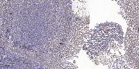 CARP Polyclonal Antibody