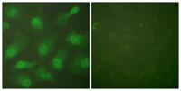 CAS Polyclonal Antibody