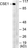 CAS Polyclonal Antibody