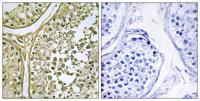 Casein Kinase I α1/1L Polyclonal Antibody