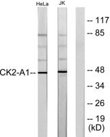 Casein Kinase IIα Polyclonal Antibody