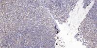 Casein Kinase IIα Polyclonal Antibody