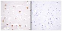 Casein Kinase IIβ Polyclonal Antibody
