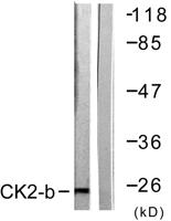 Casein Kinase IIβ Polyclonal Antibody