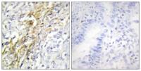 Casein Kinase Iα Polyclonal Antibody