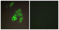 Matriptase Polyclonal Antibody