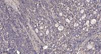 Casein Kinase Iγ1 Polyclonal Antibody
