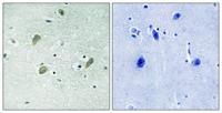 Casein Kinase Iγ1/2/3 Polyclonal Antibody
