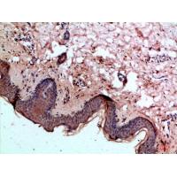 Caspase-1 Polyclonal Antibody