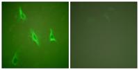 Caspase-10 B/D Polyclonal Antibody
