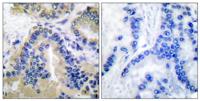 Caspase-10 B/D Polyclonal Antibody