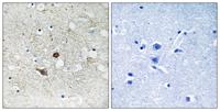 Caspase-2 Polyclonal Antibody