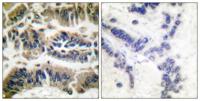 Caspase-6 Polyclonal Antibody