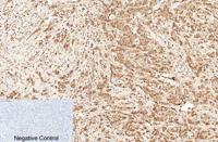 Caspase-7 Polyclonal Antibody