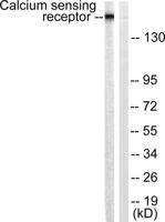 CaSR Polyclonal Antibody