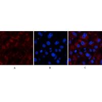 Catalase Polyclonal Antibody