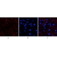 Catalase Polyclonal Antibody