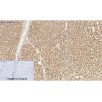 Catalase Polyclonal Antibody