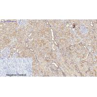 Catalase Polyclonal Antibody
