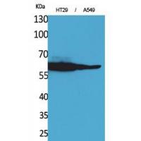 Catalase Polyclonal Antibody
