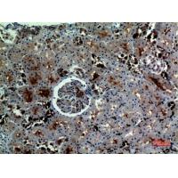 Catalase Polyclonal Antibody