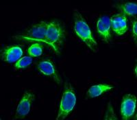 Catenin-α E/N Polyclonal Antibody