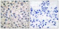 Catenin-α E/N Polyclonal Antibody