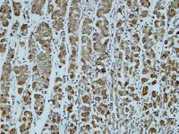 Catenin-α1 Polyclonal Antibody