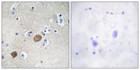 Catenin-α1 Polyclonal Antibody