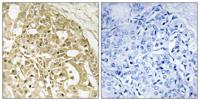 Catenin-β Polyclonal Antibody