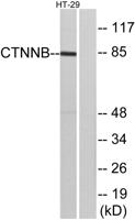 Catenin-β Polyclonal Antibody