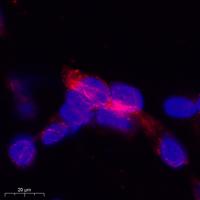 Catenin-γ Polyclonal Antibody