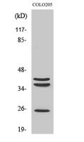 Cathepsin B Polyclonal Antibody