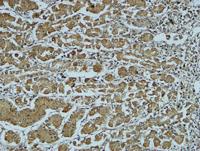Cathepsin B Polyclonal Antibody