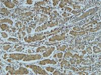 Cathepsin B Polyclonal Antibody