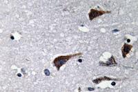 Cathepsin B Polyclonal Antibody