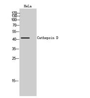 Cathepsin D Polyclonal Antibody