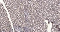 Cathepsin D Polyclonal Antibody