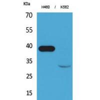 Cathepsin L Polyclonal Antibody
