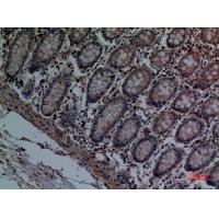 Cathepsin L Polyclonal Antibody